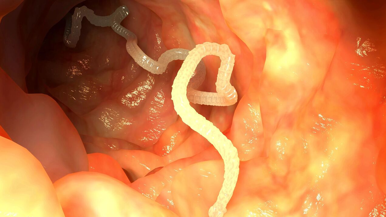 parasites in the intestine