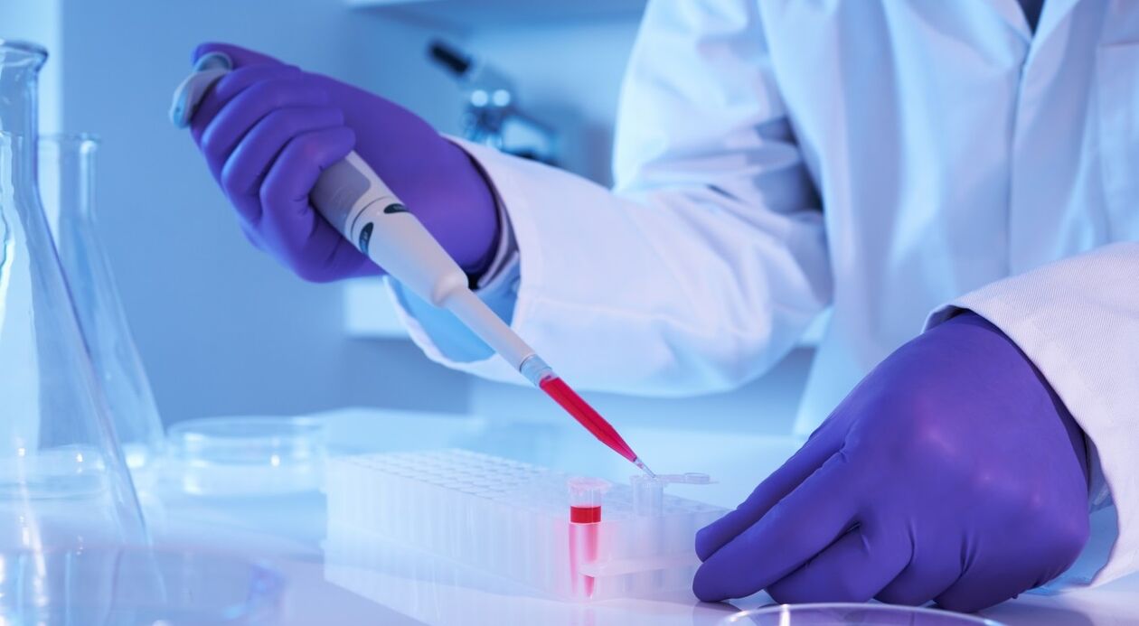 How to make an analysis of the parasite