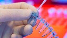 How to take tests for parasites