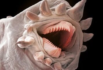 which worms can live in the human body