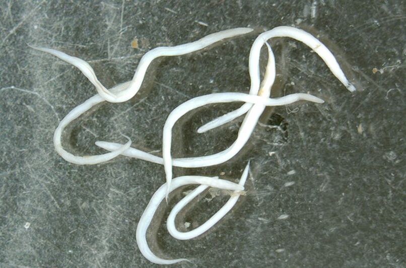 parasitic worm from the human body