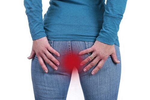 itching in the anus as an indication for parasite testing
